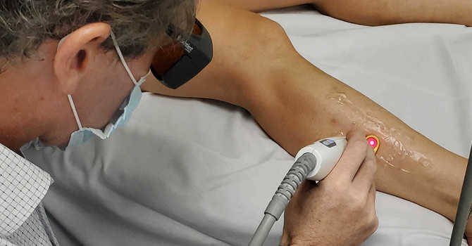 Vein Treatments