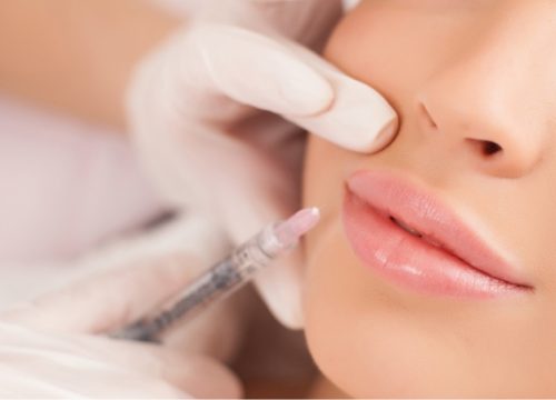 Woman getting lip injections