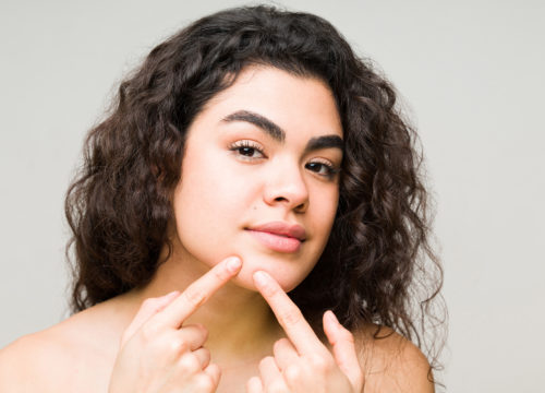 Photo of a young woman squeezing a pimple on her chin