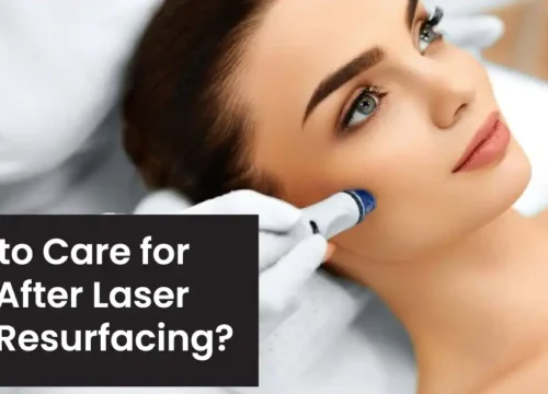 How to Care for Skin After Laser Skin Resurfacing? The Best Tips!