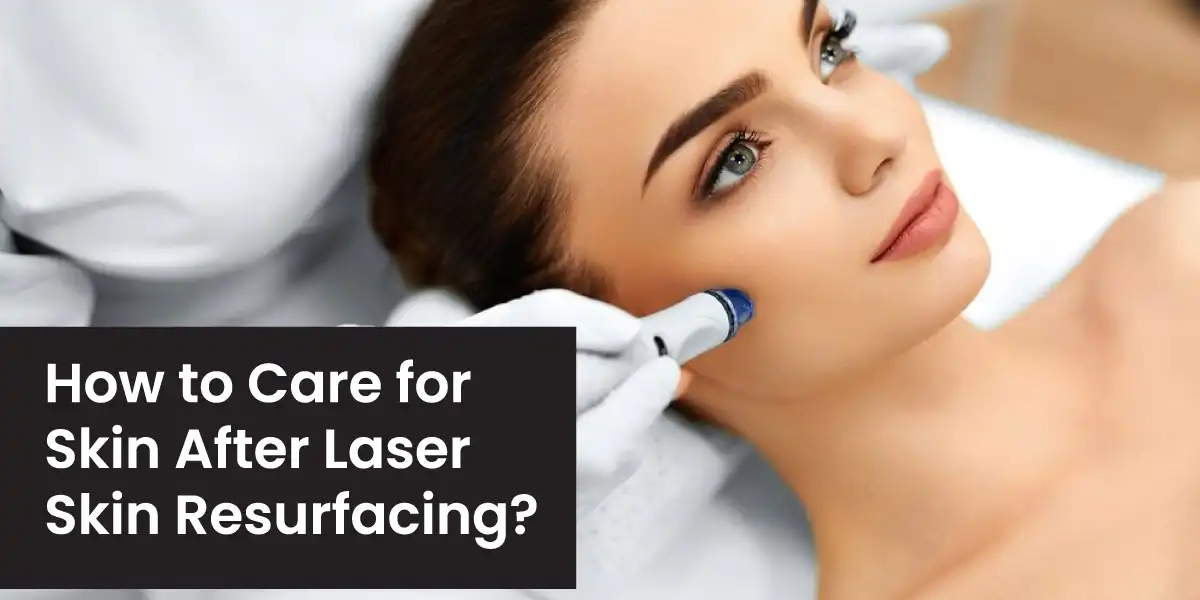 How to Care for Skin After Laser Skin Resurfacing? The Best Tips!