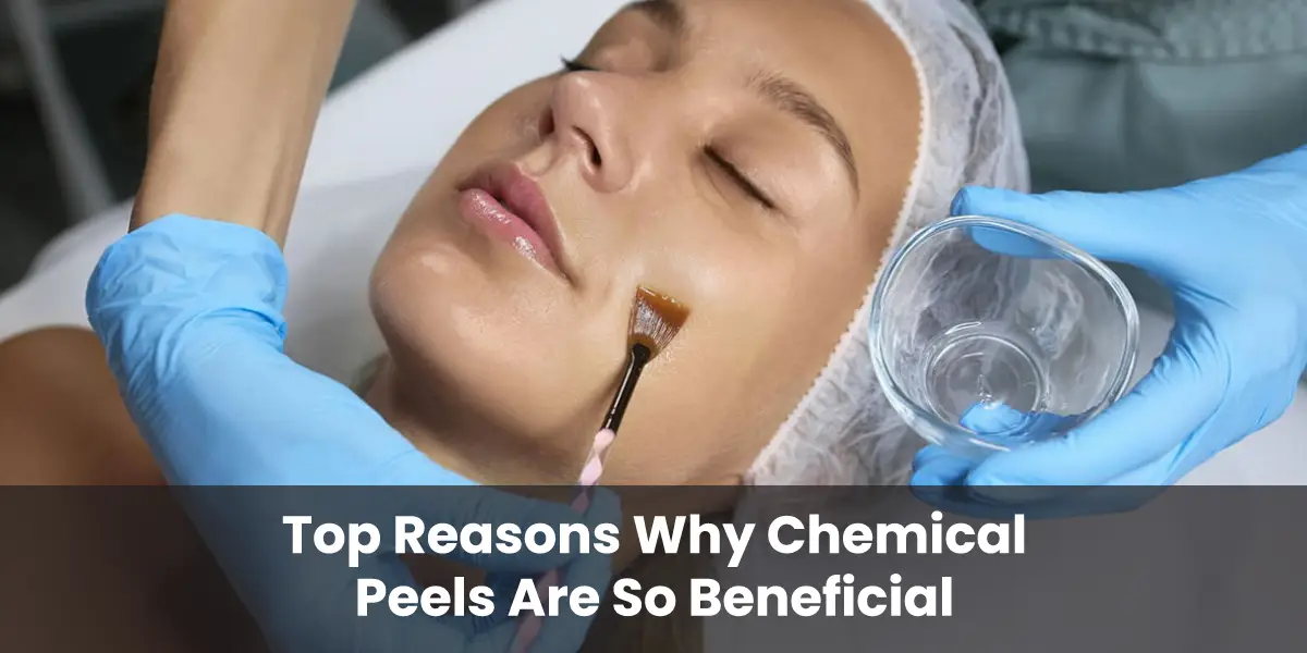 Top Reasons Why Chemical Peels Are So Beneficial!